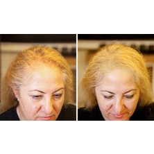 Fixplant 4 Şişe 112 gr Siyah ( Saç Gürleştirici, Saç Dolgunlaştırıcı, Saç Fiberi, Saç Tozu )