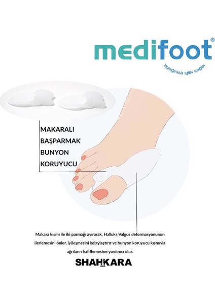 Makaralı Başparmak Bunyuon Kemik Koruyucu (Çift)