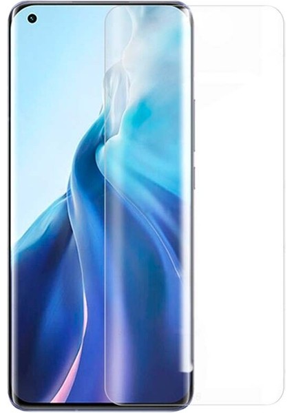 Xiaomi Mi 11 Nano Cam Ekran Koruyucu