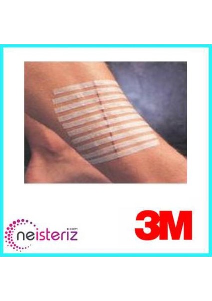 Steri-Strip Dikiş Bandı 12MM x 100MM R1547 1 Poşet