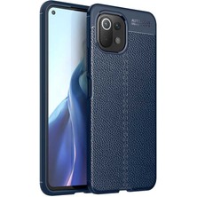 Tekno Grup Xiaomi Mi 11 Lite Kılıf Ultra Korumalı Deri Desenli Lüx Niss Silikon Kılıf + Tam Kaplayan 5d Ekran Koruyucu