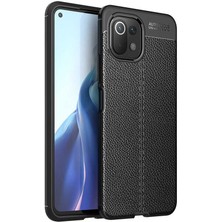 Tekno Grup Xiaomi Mi 11 Lite Kılıf Ultra Korumalı Deri Desenli Lüx Niss Silikon Kılıf + Tam Kaplayan 5d Ekran Koruyucu