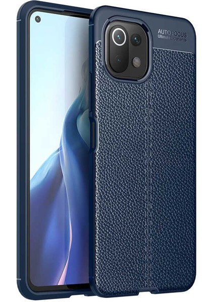 Xiaomi Mi 11 Lite Kılıf Ultra Korumalı Deri Desenli Lüx Niss Silikon Kılıf + Nano Ekran Koruyucu