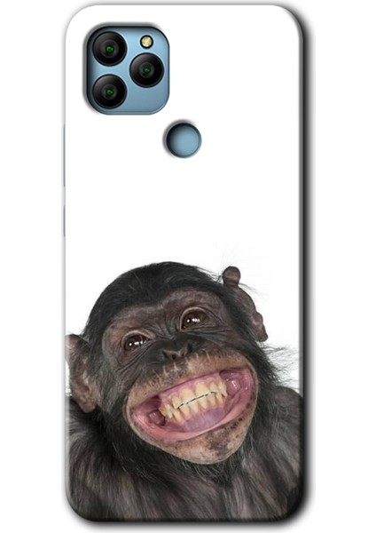 General Mobile Gm 22 Kılıf Hd Desen Baskılı Arka Kapak + Temperli Cam - Şıpsevdi Aşk