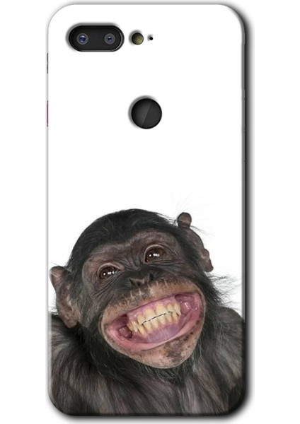 General Mobile Gm 9 Pro Kılıf Hd Desen Baskılı Arka Kapak + Temperli Cam - Şıpsevdi Aşk