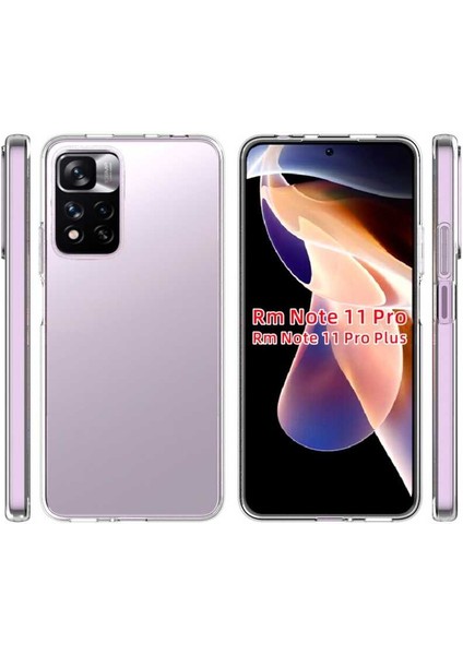 Xiaomi Redmi Note 11 Pro Plus 5g Kılıf Şeffaf Silikon Lüx