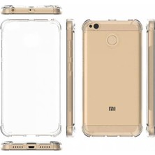 Case Street Xiaomi RedMi 4X Kılıf AntiShock Ultra Koruma+Nano Glass Şeffaf