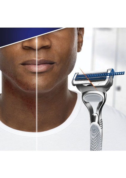 Skinguard Tıraş Makinesi Yedekli fırsatları