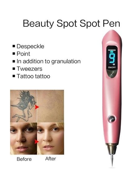 Mole Dövme Çıkarma Koyu Nokta Çıkarma Lazer Çil Çöp Çıkarma Makinesi Cilt Güzellik Enstrüman Salon Güzellik Makinesi | Evde Güzellik Cihazları