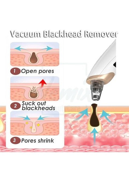 Blackhead Sökücü, Gözenek Vakudu Süper Resim Siyah Dot, Burun Gözenek Akne Yüz Temizleme, Sivil Çıkıştırıcı Güzellik Aracı, Tasarım | Evde Güzellik Cihazları