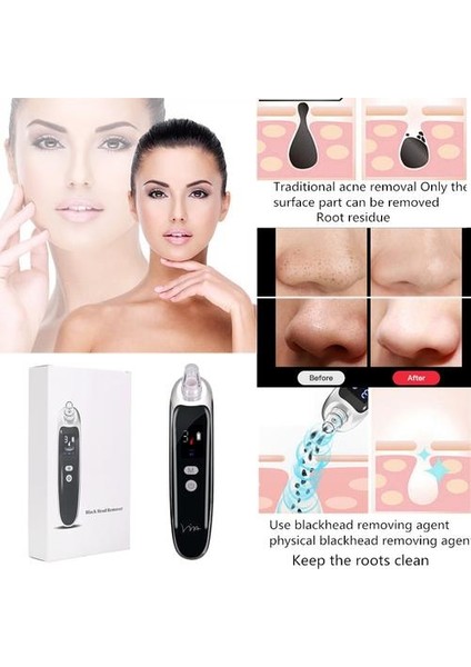 Blackhead Sökücü Güzellik Enstrümanı Vakum Temizleyici Siyah Dot Derin Gözenek Çıkarma De Siyah Kafa Çıkartma USB Şarj Aracı | Evde Güzellik Cihazları fiyatları