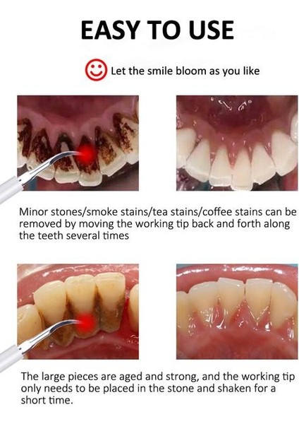 5 Modu Diş Scaler Ultrasonik Otomatik Dokunmatik Su Geçirmez Çift Kullanımlı Elektrikli Diş Fırçası Dental Calculus Remover Diş Temizleyici | Elektrikli Diş Fırçaları