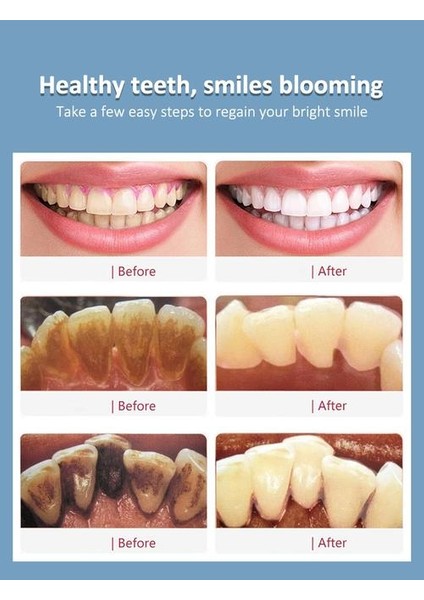 5 Modu Diş Scaler Ultrasonik Otomatik Dokunmatik Su Geçirmez Çift Kullanımlı Elektrikli Diş Fırçası Dental Calculus Remover Diş Temizleyici | Elektrikli Diş Fırçaları