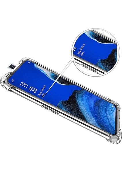 Oppo Reno 2z Kılıf Antishock Ultra Koruma Sert Kapak Şeffaf fiyatları