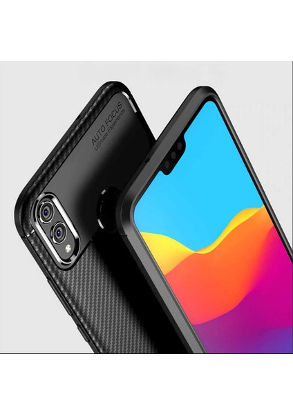 Xiaomi Mi Play Kılıf Negro Silikon Karbon Desen + Ekran Koruyucu Nano