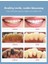 5 Modu Diş Scaler Ultrasonik Otomatik Dokunmatik Su Geçirmez Çift Kullanımlı Elektrikli Diş Fırçası Dental Calculus Remover Diş Temizleyici | Elektrikli Diş Fırçaları 4