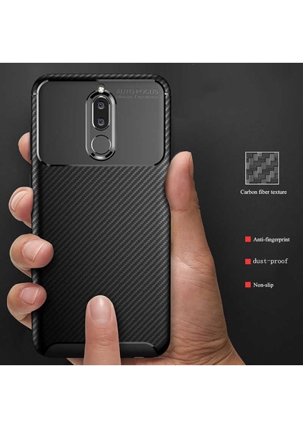 Huawei Mate 10 Lite Karbon Görünüm Negro Silikon Kılıf + Ekran Koruyucu Nano