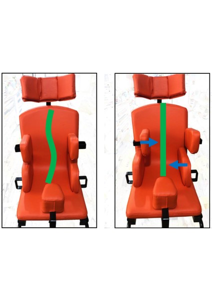 Rehabilitasyon Engelli Oturma Koltuğu Large Kullanici Boyu 140-170 cm