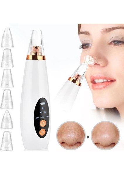 Blackhead Remover Vakum Gözenek Temizleyici Elektrikli Burun Yüz Derin Temizleme Cilt Bakım Makinesi Dropshipping Güzellik Aracı | (Yurt Dışından)