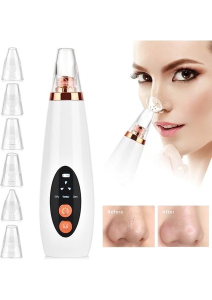 Blackhead Remover Vakum Gözenek Temizleyici Elektrikli Burun Yüz Derin Temizleme Cilt Bakım Makinesi Dropshipping Güzellik Aracı | (Yurt Dışından) indirimleri