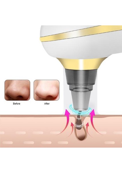 USB Siyah Başlı Çıkartma Çıkartma Yüz Derin Vakum Emme Güzellik Temiz Cilt T Bölgesi Gözenek Sivilce Siyah Dot Çıkarma Aracı | Evde Güzellik Cihazları