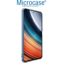 Microcase Xiaomi Redmi K40S Slim Serisi Soft Tpu Silikon Kılıf - Şeffaf