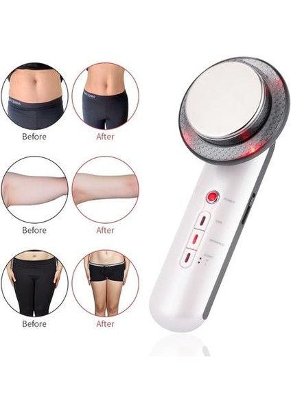 3 In 1 Ems Kızılötesi Ultrasonik Vücut Masajı Cihazı Ultrason Yağ Burner Kavitasyon Yüz Kaldırma Güzellik Makinesi | Ev Kullanımı Güzellik Cihazları (Yurt Dışından)