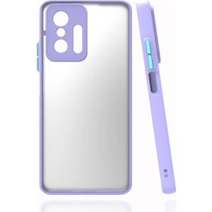 Kny Xiaomi Mi 11T Kılıf Renkli Kenarlı Buzlu Kamera Korumalı Hux Kapak