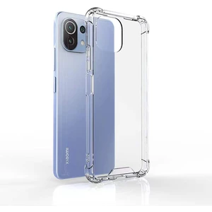 Kny Xiaomi Mi 11T Kılıf Ultra Korumalı Şeffaf Antishock Silikon