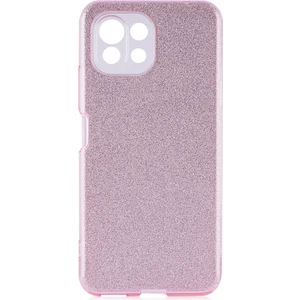 Kny Xiaomi Mi 11 Lite Kılıf Simli Parlak Shinning Silikon