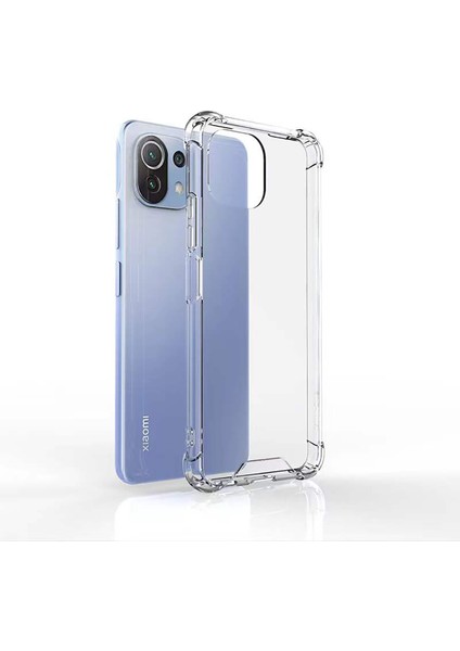 Xiaomi Mi 11T Pro Kılıf Ultra Korumalı Şeffaf Antishock Silikon