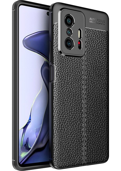 Xiaomi Mi 11T Pro Kılıf Deri Desenli Lux Niss Silikon