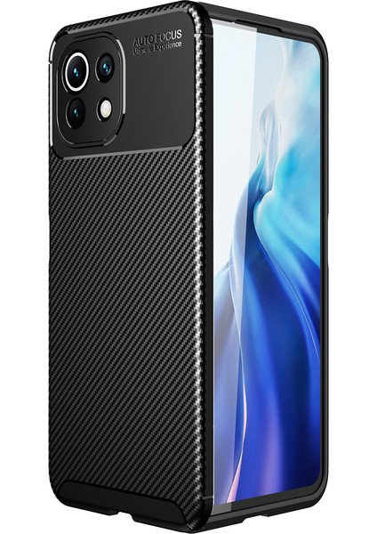 Xiaomi Mi 11 Lite Kılıf Karbon Desenli Lux Negro Silikon
