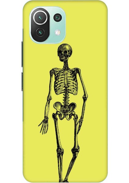 Xiaomi Mi 11 Lite Kılıf Iskelet Sarı Desenli Hd Baskılıf Silikon Kılıf - Iskeletsari