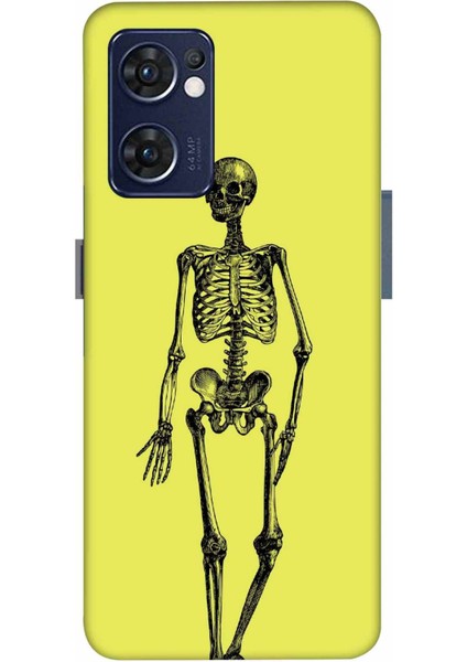 Oppo Reno 7 Kılıf Iskelet Sarı Desenli Hd Baskılıf Silikon Kılıf - Iskeletsari