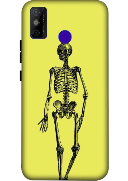 Tecno Spark 6 Go Kılıf Iskelet Sarı Desenli Hd Baskılıf Silikon Kılıf - Iskeletsari