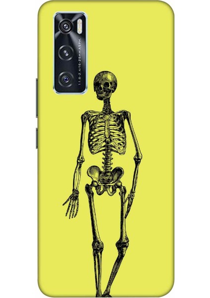 Tecno Camon 18 Kılıf Iskelet Sarı Desenli Hd Baskılıf Silikon Kılıf - Iskeletsari