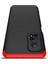 Xiaomi Mi 10T Pro Kılıf 3 Parça 360 Zore Ays Kapak 3