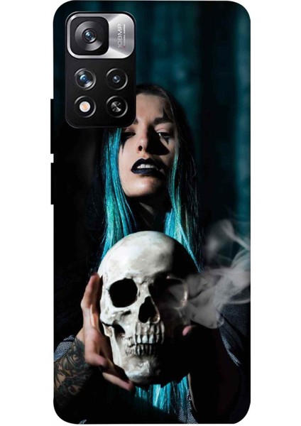 Xiaomi Redmi Note 11S Kılıf Nefret Desenli Hd Baskılıf Silikon Kılıf - Nefret