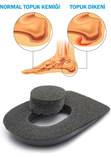 Heelspur (Epin Topukluk) Gri Topuk Dikeni Tabanlık fiyatları