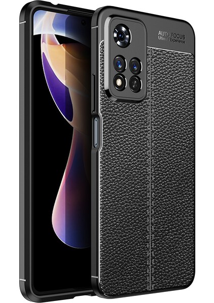 Xiaomi Redmi Note 11 Pro Kılıf Deri Desenli Lux Niss Silikon