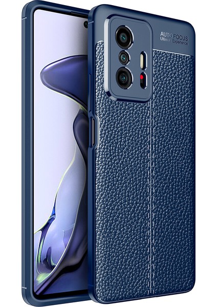 Xiaomi Mi 11T Kılıf Deri Desenli Lux Niss Silikon