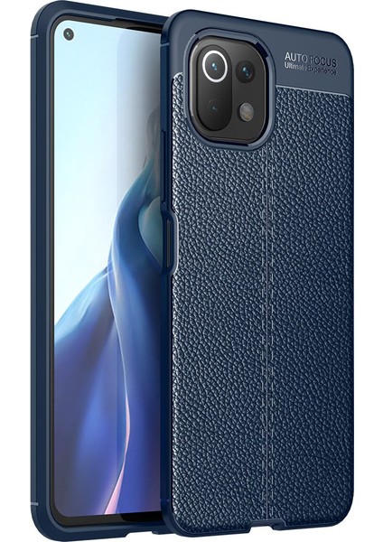 Xiaomi Mi 11 Lite Kılıf Deri Desenli Lux Niss Silikon