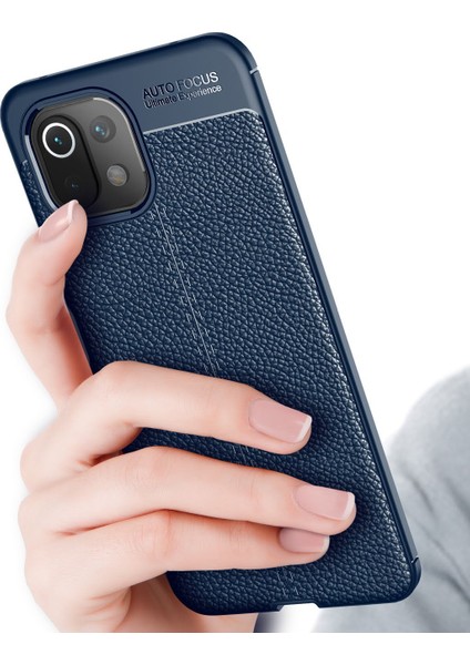 Xiaomi Mi 11 Lite Kılıf Deri Desenli Lux Niss Silikon fırsatları