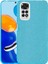 Xiaomi Redmi Note 11 Kılıf Simli Parlak Shining Silikon 1