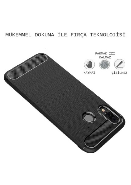 Xiaomi Mi A2 Kılıf Carbon Brushed Soft TPU Silikon Xiaomi Mi A2 Kılıf Siyah