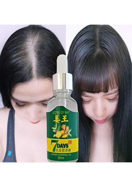 30ml Gingergerminalessentialoil Hair Growth Loss Treatment Serum Unisex 3 Adet Saç Bakım Yağı