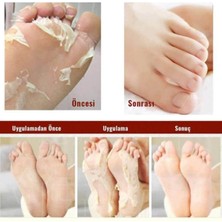 Marlett Foot Peeling Pack- Soyulan Ayak Maskesi