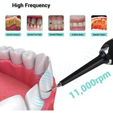 Sanlindou Elektrik 7in1 Diş Scaler Titreşim Diş Hesap Sökücü Sonic Yüksek Frekanslı  Tartar Diş Fırçası Temizleyici Taşınabilir (Yurt Dışından)