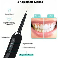 Sanlindou Elektrik 7in1 Diş Scaler Titreşim Diş Hesap Sökücü Sonic Yüksek Frekanslı  Tartar Diş Fırçası Temizleyici Taşınabilir (Yurt Dışından)